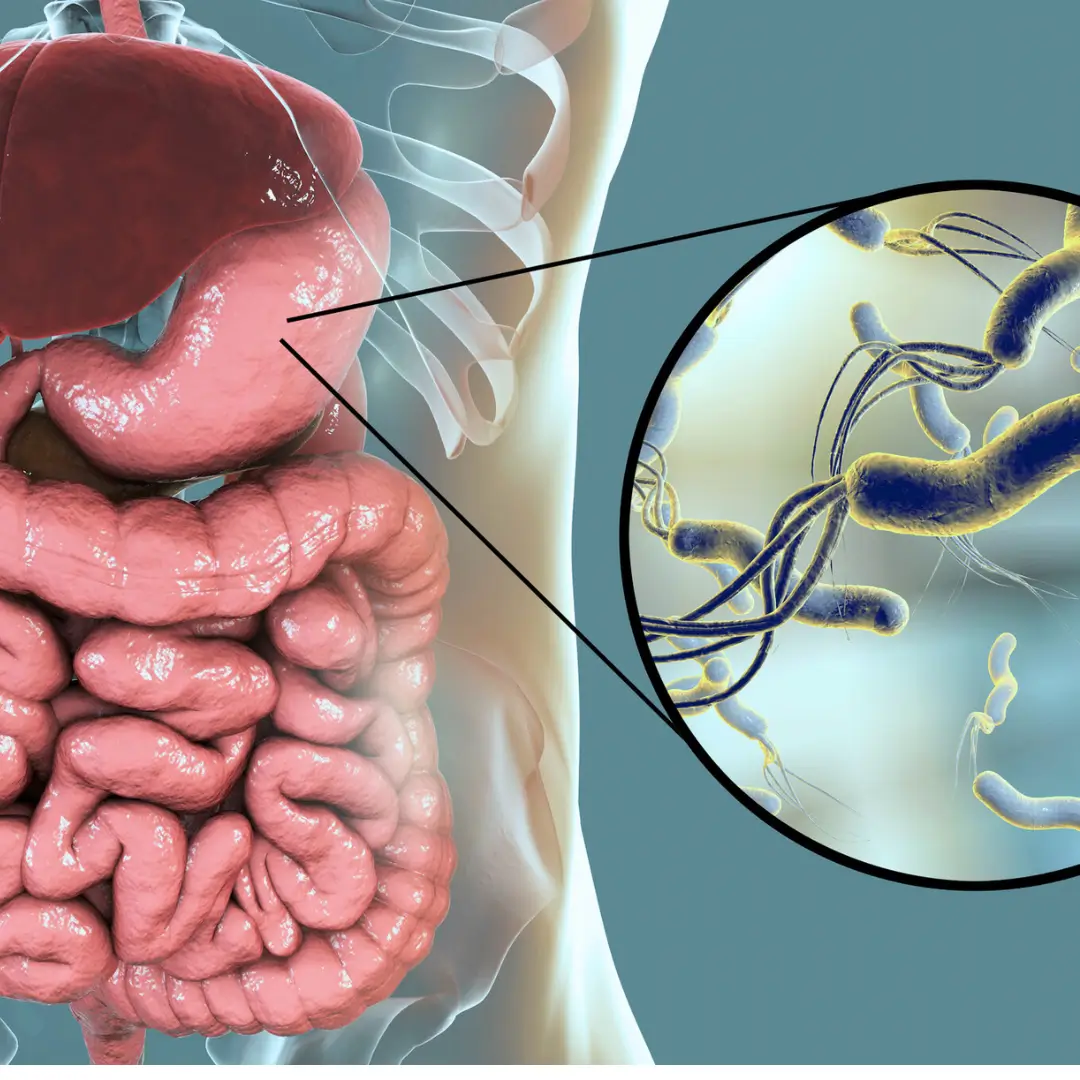 Naturalne wsparcie na Helicobacter pylori